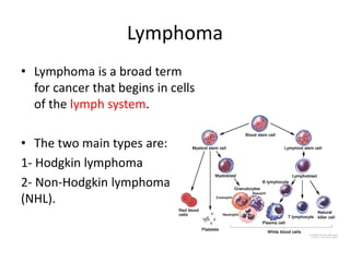 Lymphoma
• Lymphoma is a broad term
for cancer that begins in cells
of the lymph system.
• The two main types are:
1- Hodgkin lymphoma
2- Non-Hodgkin lymphoma
(NHL).
 