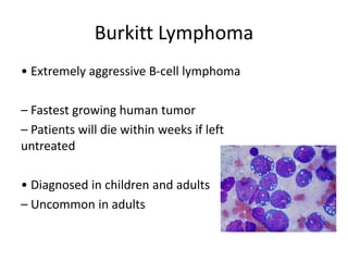 Burkitt Lymphoma
• Extremely aggressive B‐cell lymphoma
– Fastest growing human tumor
– Patients will die within weeks if left
untreated
• Diagnosed in children and adults
– Uncommon in adults
 