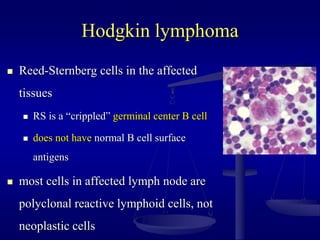 Hodgkin lymphoma
 Reed-Sternberg cells in the affected
tissues
 RS is a “crippled” germinal center B cell
 does not have normal B cell surface
antigens
 most cells in affected lymph node are
polyclonal reactive lymphoid cells, not
neoplastic cells
 