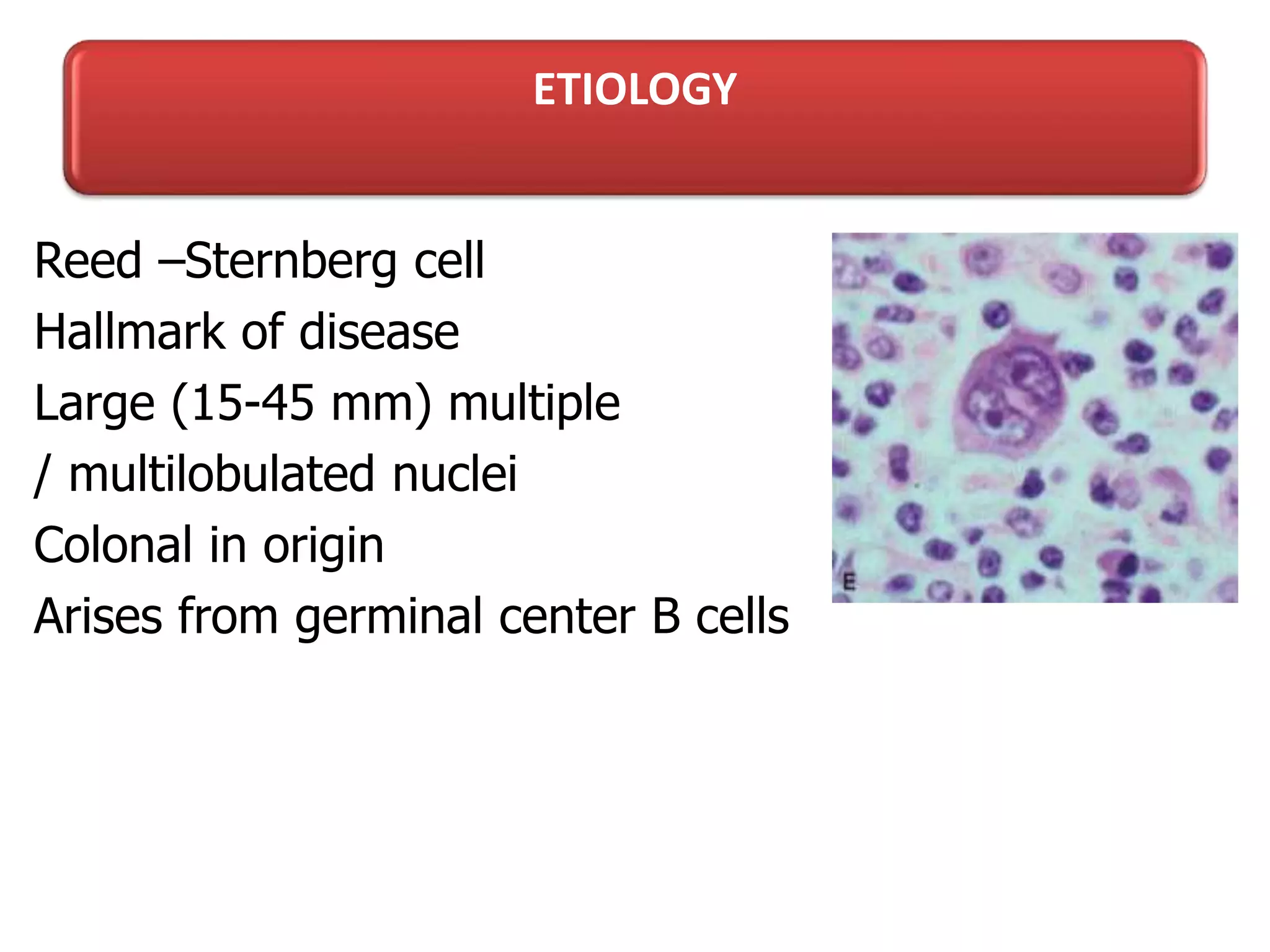 Lymphoma in children Dr G.Rajkumar | PPTX