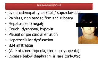 CLINICAL MANIFESTATIONS
• Lymphadenopathy cervical / supraclavicular
• Painless, non tender, firm and rubbery
• Hepatosplenomegaly
• Cough, dyspnoea, hypoxia
• Pleural or pericardial effusion
• Hepatocellular dysfunction
• B.M infiltration
• (Anemia, neutropenia, thrombocytopenia)
• Disease below diaphragm is rare (only3%)
 