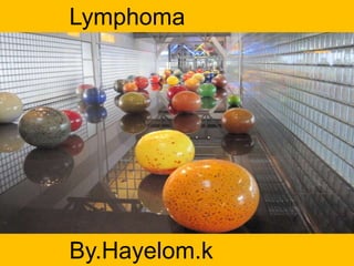Lymphoma
By.Hayelom.k
 