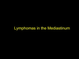 Lymphomas in the Mediastinum
 