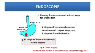 Fischbach Best Practice & Research Clinical Gastroenterology 2014
ENDOSCOPIE
 