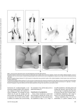 Lymphoscintigraphy lymphedema of extremities_Pictorial Essay.pdf