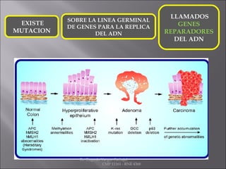 EXISTE
MUTACION
SOBRE LA LINEA GERMINAL
DE GENES PARA LA REPLICA
DEL ADN
LLAMADOS
GENES
REPARADORES
DEL ADN
Dr. Eugenio Vargas Carbajal
CMP 11161 - RNE 4368
 