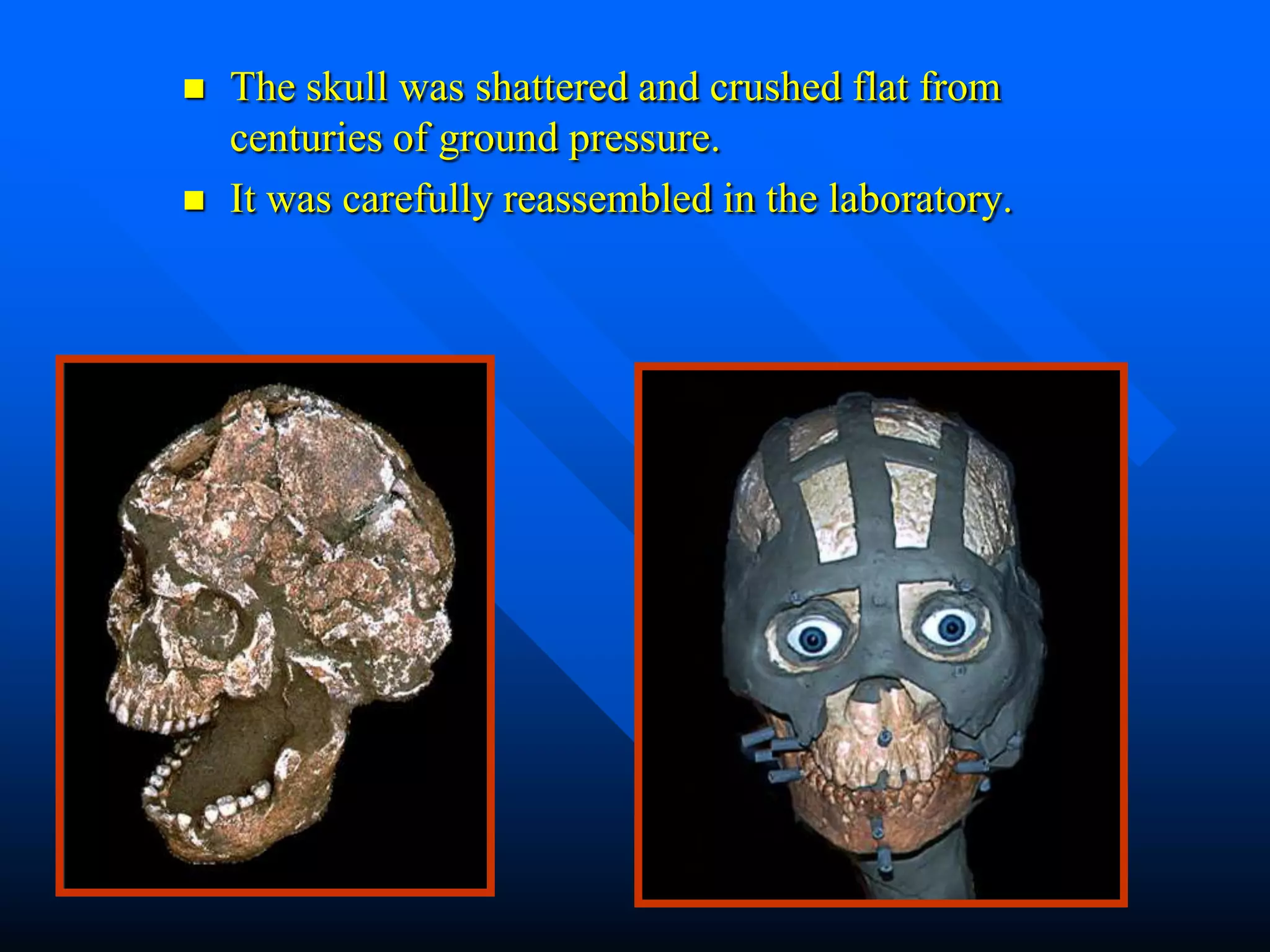    The skull was shattered and crushed flat from
    centuries of ground pressure.
   It was carefully reassembled in the laboratory.
 