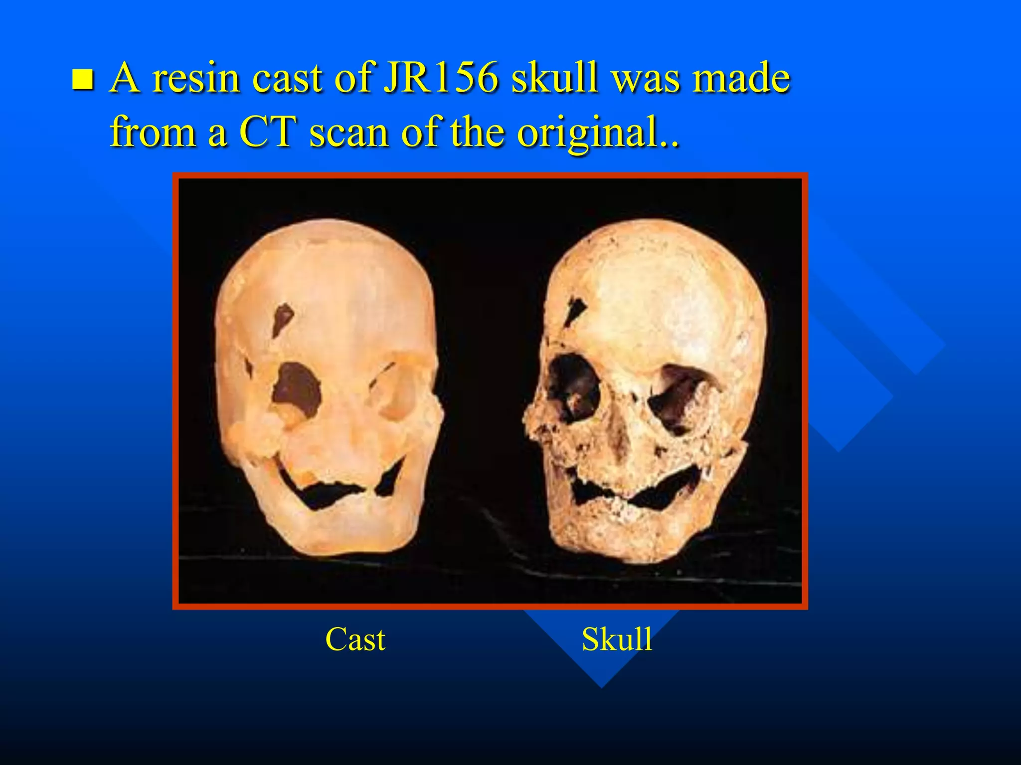    A resin cast of JR156 skull was made
    from a CT scan of the original..




               Cast         Skull
 