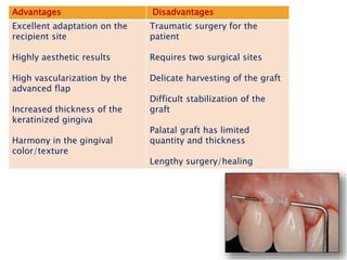 Advantages Disadvantages
Excellent adaptation on the
recipient site
Highly aesthetic results
High vascularization by the
advanced flap
Increased thickness of the
keratinized gingiva
Harmony in the gingival
color/texture
Traumatic surgery for the
patient
Requires two surgical sites
Delicate harvesting of the graft
Difficult stabilization of the
graft
Palatal graft has limited
quantity and thickness
Lengthy surgery/healing
 