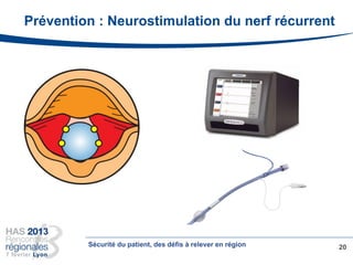 Prévention : Neurostimulation du nerf récurrent
20Sécurité du patient, des défis à relever en région
 