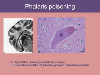 Phalaris poisoning
• A. Pigmentation in lateral geniculate body (arrow)
• B. Neuronal accumulation of granular pigmented material (arrow head)
B
 