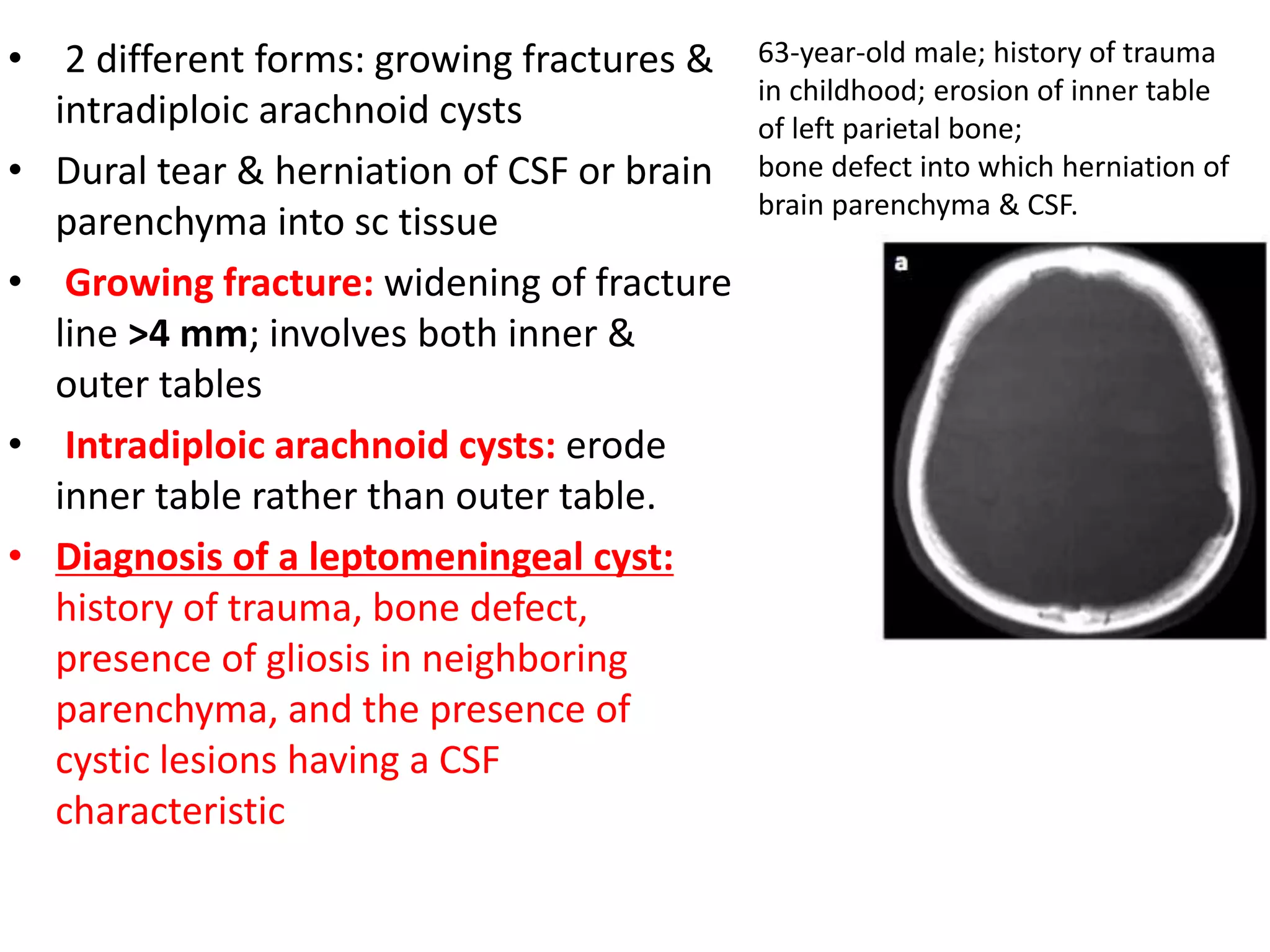 • 2 different forms: growing fractures &
intradiploic arachnoid cysts
• Dural tear & herniation of CSF or brain
parenchyma into sc tissue
• Growing fracture: widening of fracture
line >4 mm; involves both inner &
outer tables
• Intradiploic arachnoid cysts: erode
inner table rather than outer table.
• Diagnosis of a leptomeningeal cyst:
history of trauma, bone defect,
presence of gliosis in neighboring
parenchyma, and the presence of
cystic lesions having a CSF
characteristic
63-year-old male; history of trauma
in childhood; erosion of inner table
of left parietal bone;
bone defect into which herniation of
brain parenchyma & CSF.
 