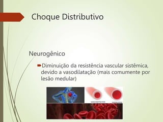 Choque Distributivo
Neurogênico
Diminuição da resistência vascular sistêmica,
devido a vasodilatação (mais comumente por
lesão medular)
 