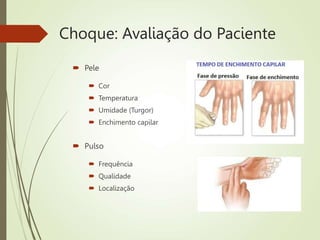 Choque: Avaliação do Paciente
 Pele
 Cor
 Temperatura
 Umidade (Turgor)
 Enchimento capilar
 Pulso
 Frequência
 Qualidade
 Localização
 