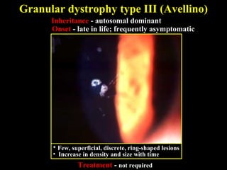 Inheritance - autosomal dominant
Onset - late in life; frequently asymptomatic
• Few, superficial, discrete, ring-shaped lesions
• Increase in density and size with time
Treatment - not required
Granular dystrophy type III (Avellino)
 