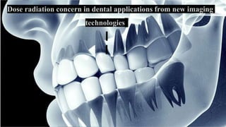 Dose radiation concern in dental applications from new imaging
technologies
1
 