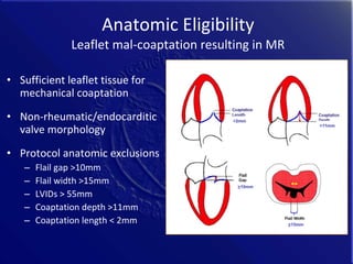 History and Future of Transcatheter Mitral Valve Interventions | PPT