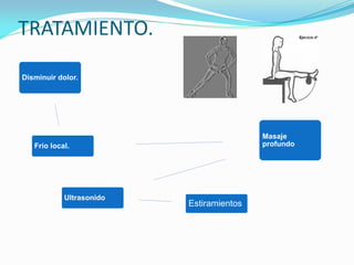 TRATAMIENTO.
Disminuir dolor.
Frío local.
Masaje
profundo
Ultrasonido
Estiramientos
 