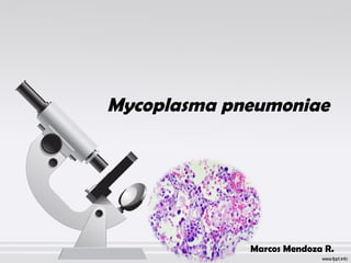 Mycoplasma pneumoniae 
Marcos Mendoza R. 
 
