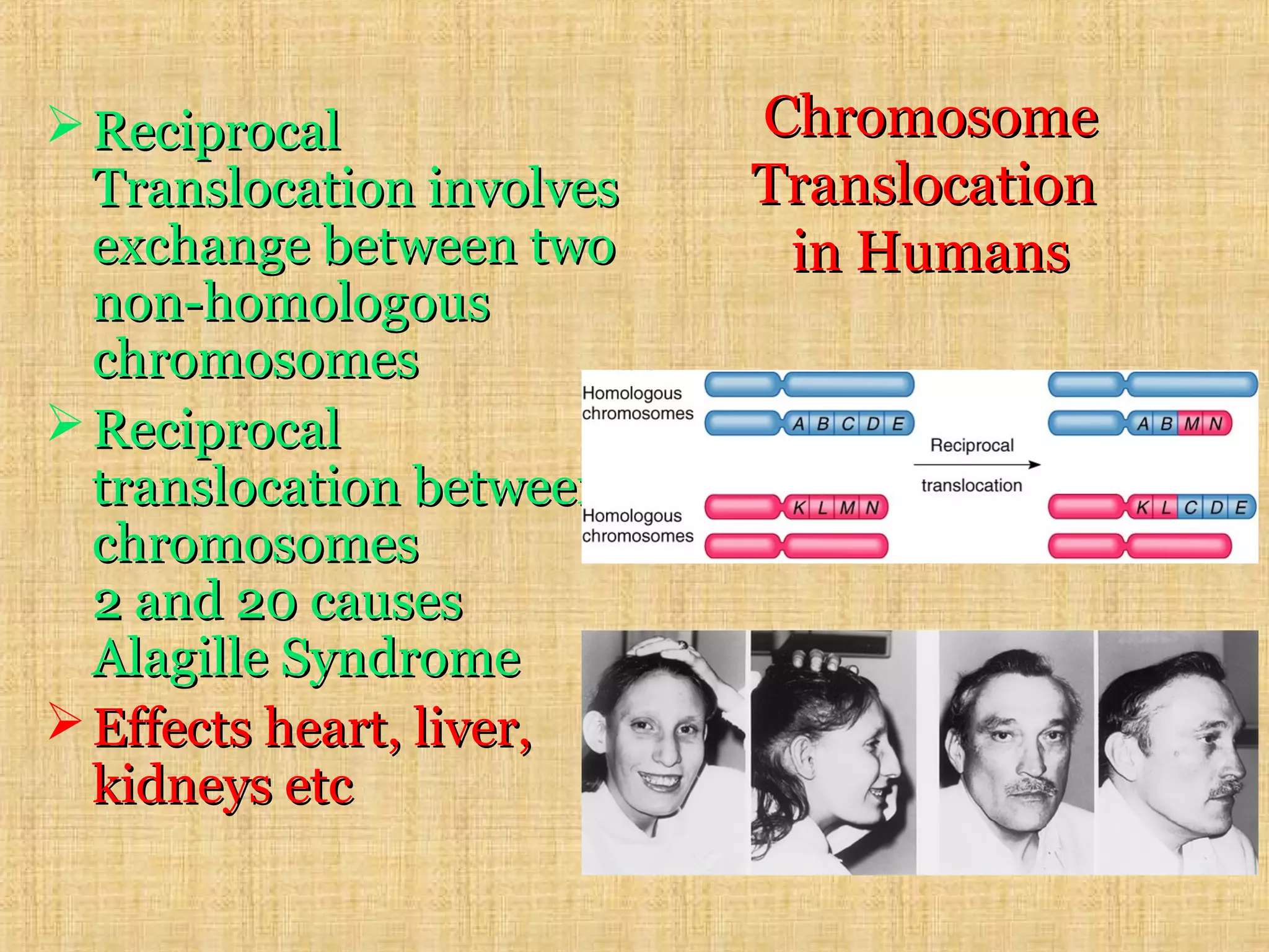 ChromosomeChromosome
TranslocationTranslocation
in Humansin Humans
 ReciprocalReciprocal
Translocation involvesTranslocation involves
exchange between twoexchange between two
non-homologousnon-homologous
chromosomeschromosomes
 ReciprocalReciprocal
translocation betweentranslocation between
chromosomeschromosomes
2 and 20 causes2 and 20 causes
Alagille SyndromeAlagille Syndrome
 Effects heart, liver,Effects heart, liver,
kidneys etckidneys etc
 