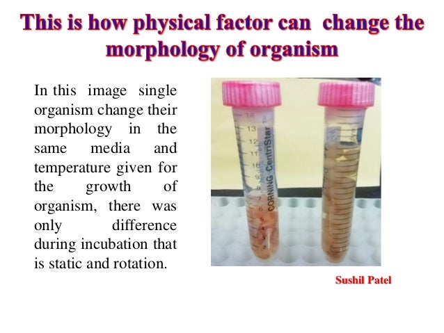 Sushil Patel
In this image single
organism change their
morphology in the
same media and
temperature given for
the growth ...