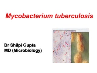 Mycobacterium tuberculosis
Dr Shilpi Gupta
MD (Microbiology)
 