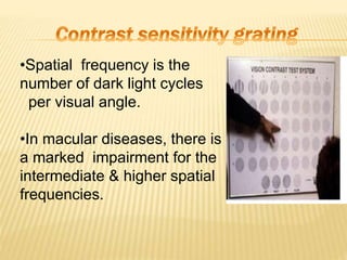 •Spatial frequency is the
number of dark light cycles
per visual angle.
•In macular diseases, there is
a marked impairment for the
intermediate & higher spatial
frequencies.
 