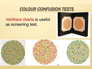COLOUR CONFUSION TESTS
•Ishihara charts is useful
as screening test.
 