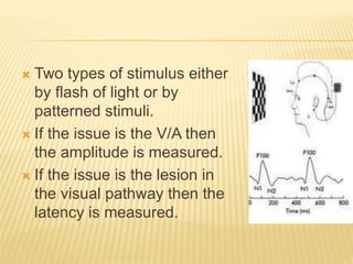 Two types of stimulus either
by flash of light or by
patterned stimuli.
 If the issue is the V/A then
the amplitude is measured.
 If the issue is the lesion in
the visual pathway then the
latency is measured.
 