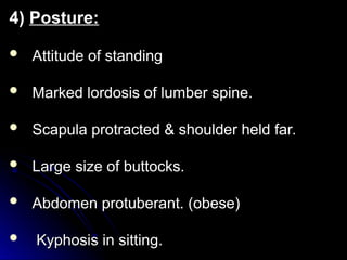 4)
4) Posture:
Posture:
 Attitude of standing
Attitude of standing
 Marked lordosis of lumber spine.
Marked lordosis of lumber spine.
 Scapula protracted & shoulder held far.
Scapula protracted & shoulder held far.
 Large size of buttocks.
Large size of buttocks.
 Abdomen protuberant. (obese)
Abdomen protuberant. (obese)
 Kyphosis in sitting.
Kyphosis in sitting.
 