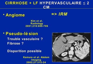 CIRRHOSE + LF  HYPERVASCULAIRE ≤ 2 CM Angiome Pseudo-lésion Trouble vasculaire ? Fibrose ? Disparition possible Kamura et al. Abdom Imaging 2002;27:315-24 Kim et al. Radiology 2001;219:699-706 => IRM 