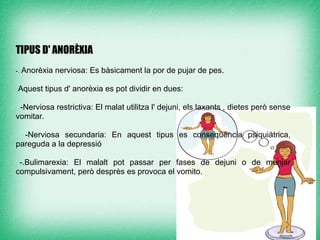 TIPUS D' ANORÈXIA

-. Anorèxia   nerviosa: Es bàsicament la por de pujar de pes.

    Aquest tipus d' anorèxia es pot dividir en dues:

 -Nerviosa restrictiva: El malat utilitza l' dejuni, els laxants , dietes però sense
vomitar.

  -Nerviosa secundaria: En aquest tipus es conseqüència psiquiàtrica,
pareguda a la depressió

 -.Bulimarexia: El malalt pot passar per fases de dejuni o de menjar
compulsivament, però desprès es provoca el vomito.
 