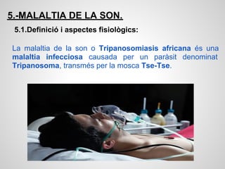 5.-MALALTIA DE LA SON.
 5.1.Definició i aspectes fisiològics:

La malaltia de la son o Tripanosomiasis africana és una
malaltia infecciosa causada per un paràsit denominat
Tripanosoma, transmés per la mosca Tse-Tse.
 