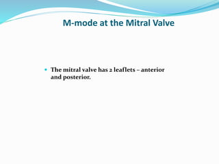 M-mode at the Mitral Valve
 The mitral valve has 2 leaflets – anterior
and posterior.
 