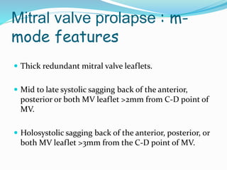 Mitral valve prolapse : m-
mode features
 Thick redundant mitral valve leaflets.
 Mid to late systolic sagging back of the anterior,
posterior or both MV leaflet >2mm from C-D point of
MV.
 Holosystolic sagging back of the anterior, posterior, or
both MV leaflet >3mm from the C-D point of MV.
 