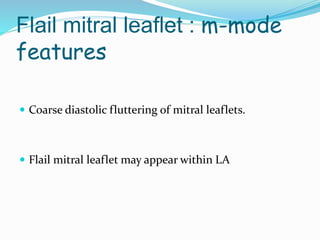 Flail mitral leaflet : m-mode
features
 Coarse diastolic fluttering of mitral leaflets.
 Flail mitral leaflet may appear within LA
 