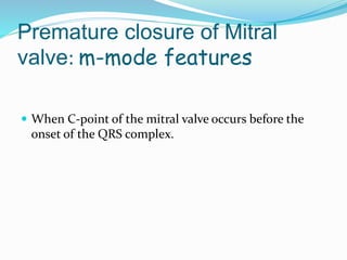 Premature closure of Mitral
valve: m-mode features
 When C-point of the mitral valve occurs before the
onset of the QRS complex.
 