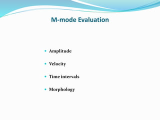 M-mode Evaluation
 Amplitude
 Velocity
 Time intervals
 Morphology
 