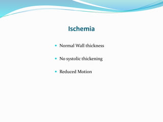 Ischemia
 Normal Wall thickness
 No systolic thickening
 Reduced Motion
 