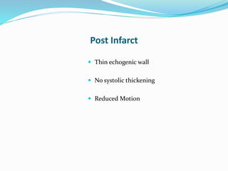 Post Infarct
 Thin echogenic wall
 No systolic thickening
 Reduced Motion
 