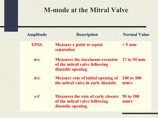 M mode echocardiography | PPT