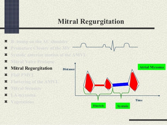 Measuring Left Ventricular Ejection Fraction Techniques And