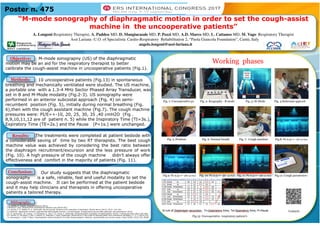 “M-mode sonography of diaphragmatic motion in order to set the cough-assist
machine in the uncooperative patients”
A. Longoni Respiratory Therapist, A. Paddeu MD, D. Mangiacasale MD, P. Pozzi MD, A.D. Marco MD, L. Cattaneo MD, M. Vago Respiratory Therapist
Asst Lariana -U.O. of Specialistic Cardio-Respiratory Rehabilitation 2, “Paola Giancola Foundation”, Cantù, Italy
angelo.longoni@asst-lariana.it
M-mode sonograpny (US) of the diaphragmatic
motion may be an aid for the respiratory therapist to better
calibrate the cough-assist machine in uncooperative patients (Fig.1).
1 G. Soldati, R. Copetti, Ecografia toracica (2012)
2 Winfocus’ Lung ultrasound for anesthesia & intensive care (WLUS-AIC)
3 A. Sarwal, F. O. Walker, M. S. Cartwright, Neuromuscular Ultrasound for evaluation of diaphragm. Muscle Nerve (2013), 47(3): 319-329;
4 A.Zanforlin, Applicazioni cliniche e sperimentali dell’ecografia toracica in pneumologia: la diagnostica precoce delle patologie pleuropolmonari (2012)
5.E. O. Gerscovich, M. Cronan. J. P. McGahan, K. Jain, C. D. Jones, C. McDonald, Ultrasonographic evaluation of diaphragmatic motion. J Ultrasound Med (2001) 597-604;
6 G. Ferrari, G. De Filippi, F. Elia, F. Panero, G. Volpicelly, F. Aprà, Diaphragm ultrasound as a new index of discontinuation from mechanical ventilation. C. U. J. (2014) 6:8
7 A. Boussuges, Y. Gole, P. Blanc, Diaphragmatic motion studied by M-mode ultrasonography: Methods, reproducibility and normal values. Chest (2009) 135(2):391-40089
 
Our study suggests that the diaphragmatic
sonography is a safe, reliable, fast and useful modality to set the
cough-assist machine. It can be performed at the patient bedside
and it may help clinicians and therapists in offering uncooperative
patients a tailored therapy.
The treatments were completed at patient bedside with
a considerable saving of time by two RT therapists. The best cough
machine value was achieved by considering the best ratio between
the diaphragm recruitment/excursion and the less pressure of work
(Fig. 10). A high pressure of the cough machine didn’t always offer
effectiveness and comfort in the majority of patients (Fig. 11).
10 uncooperative patients (Fig.13) in spontaneous
breathing and mechanically ventilated were studied. The US machine,
a portable one with a 1.3-4 MHz Sector Phased Array Transducer, was
set in B and M-Mode modality (Fig.2-3). US sonography were
performed in an anterior subcostal approach (Fig. 4) on semi-
recumbent position (Fig. 5), initially during normal breathing (Fig.
6),then with the cough assistant machine (Fig.7). The cough machine
pressures were: PI/E=+-10, 20, 25, 30, 35 ,40 cmH2O (Fig .
8,9,10,11,12 are of patient n. 5) while the Inspiratory Time (TI=3s.),
Expiratory Time (TE=2s.) and the Pause (P=1s.) were unchanged.
Poster n. 475
Objective:
Methods:
Results:
Working phases
Fig. 1: Uncooperative pz. Fig. 2: Ecography –B mode Fig. 3: M-Mode Fig. 4:Subcostal approch
Fig.9: Pz n.5=+- 20 cm H2O Fig. 10: Pz n.5=+- 30 cm H2O Fig. 11: Pz n.5=+- 40 cm H2O Fig.12: Cough parameters
Fig.13: Uncooperative respiratory patient’s
Fig. 5 :Position Fig. 6: Normal breath Fig. 7: Cough machine Fig.8: Pz n.5=+- 10 cm H2O
Conclusion:
Contacts
Bibliography:
 