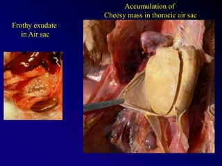 Frothy exudate
in Air sac
Accumulation of
Cheesy mass in thoracic air sac
 