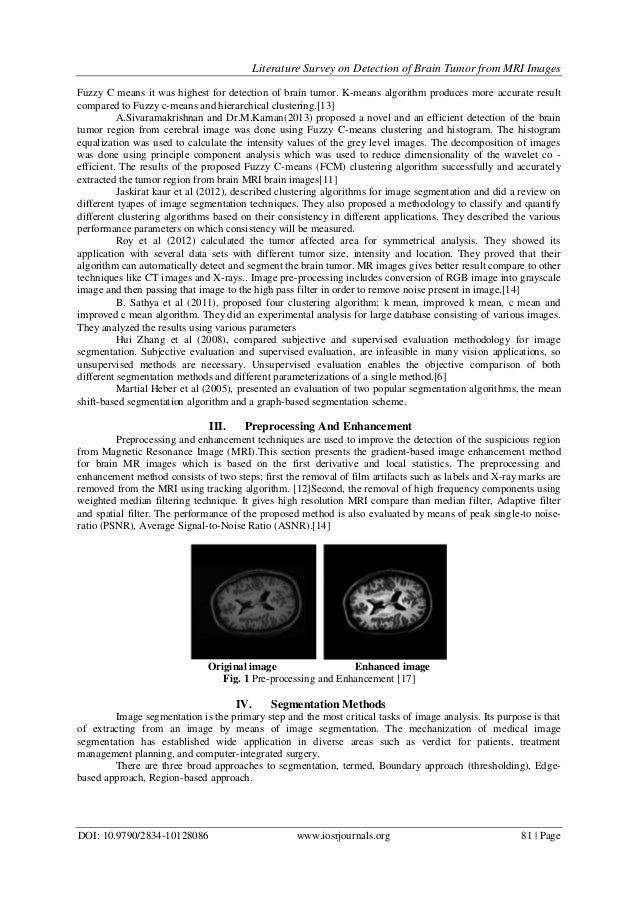 Problem statement for brain tumor detection picture