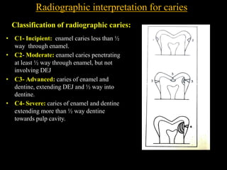 M0302. principles of radigraphic interpretation. 2.pdf