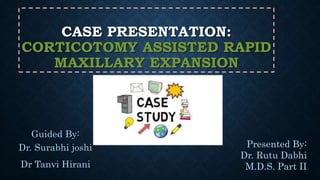 CASE PRESENTATION:
CORTICOTOMY ASSISTED RAPID
MAXILLARY EXPANSION
Guided By:
Dr. Surabhi joshi
Dr Tanvi Hirani
Presented By:
Dr. Rutu Dabhi
M.D.S. Part II
 