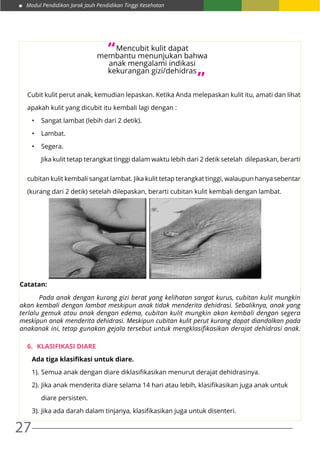Modul Pendidikan Jarak Jauh Pendidikan Tinggi Kesehatan
27
Cubit kulit perut anak, kemudian lepaskan. Ketika Anda melepaskan kulit itu, amati dan lihat
apakah kulit yang dicubit itu kembali lagi dengan :
•	 Sangat lambat (lebih dari 2 detik).
•	 Lambat.
•	 Segera.
	 Jika kulit tetap terangkat tinggi dalam waktu lebih dari 2 detik setelah dilepaskan, berarti
cubitan kulit kembali sangat lambat. Jika kulit tetap terangkat tinggi, walaupun hanya sebentar
(kurang dari 2 detik) setelah dilepaskan, berarti cubitan kulit kembali dengan lambat.
Catatan:
	 Pada anak dengan kurang gizi berat yang kelihatan sangat kurus, cubitan kulit mungkin
akan kembali dengan lambat meskipun anak tidak menderita dehidrasi. Sebaliknya, anak yang
terlalu gemuk atau anak dengan edema, cubitan kulit mungkin akan kembali dengan segera
meskipun anak menderita dehidrasi. Meskipun cubitan kulit perut kurang dapat diandalkan pada
anakanak ini, tetap gunakan gejala tersebut untuk mengklasifikasikan derajat dehidrasi anak.
6.	 KLASIFIKASI DIARE
Ada tiga klasifikasi untuk diare.
1).	Semua anak dengan diare diklasifikasikan menurut derajat dehidrasinya.
2).	Jika anak menderita diare selama 14 hari atau lebih, klasifikasikan juga anak untuk
	 diare persisten.
3).	Jika ada darah dalam tinjanya, klasifikasikan juga untuk disenteri.
Mencubit kulit dapat
membantu menunjukan bahwa
anak mengalami indikasi
kekurangan gizi/dehidras
“
“
 
