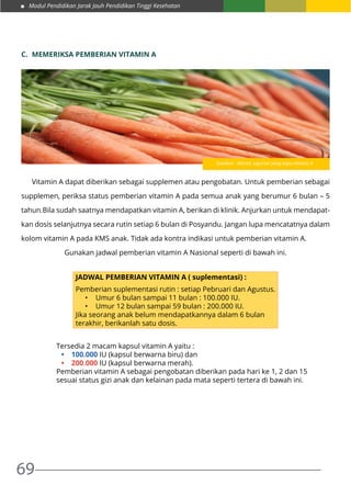 Modul Pendidikan Jarak Jauh Pendidikan Tinggi Kesehatan
69
C.	 MEMERIKSA PEMBERIAN VITAMIN A
	 Vitamin A dapat diberikan sebagai supplemen atau pengobatan. Untuk pemberian sebagai
supplemen, periksa status pemberian vitamin A pada semua anak yang berumur 6 bulan – 5
tahun.Bila sudah saatnya mendapatkan vitamin A, berikan di klinik. Anjurkan untuk mendapat-
kan dosis selanjutnya secara rutin setiap 6 bulan di Posyandu. Jangan lupa mencatatnya dalam
kolom vitamin A pada KMS anak. Tidak ada kontra indikasi untuk pemberian vitamin A.
Gunakan jadwal pemberian vitamin A Nasional seperti di bawah ini.
JADWAL PEMBERIAN VITAMIN A ( suplementasi) :
Pemberian suplementasi rutin : setiap Pebruari dan Agustus.
•	 Umur 6 bulan sampai 11 bulan : 100.000 IU.
•	 Umur 12 bulan sampai 59 bulan : 200.000 IU.
Jika seorang anak belum mendapatkannya dalam 6 bulan
terakhir, berikanlah satu dosis.
Tersedia 2 macam kapsul vitamin A yaitu :
•	 100.000 IU (kapsul berwarna biru) dan
•	 200.000 IU (kapsul berwarna merah).
Pemberian vitamin A sebagai pengobatan diberikan pada hari ke 1, 2 dan 15
sesuai status gizi anak dan kelainan pada mata seperti tertera di bawah ini.
Gambar : Wortel, sayuran yang kaya vitamin A
 