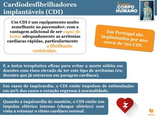 Cardiodesfibrilhadores
implantáveis (CDI)
Em Portugal sãoimplantados por anocerca de 720 CDI.
Em Portugal sãoimplantados por anocerca de 720 CDI.
Um CDI é um equipamento muito
semelhante ao pacemaker, com a
vantagem adicional de ser capaz de
tratar adequadamente as arritmias
cardíacas rápidas, particularmente
a fibrilhação
ventricular.
É a única terapêutica eficaz para evitar a morte súbita em
doentes com risco elevado de ter este tipo de arritmias (ex:
doentes que já entraram em paragem cardíaca).
Em casos de taquicardia, o CDI emite impulsos de estimulação:
em 90% dos casos o coração regressa à normalidade.
Quando a taquicardia de mantém, o CDI emite um
impulso elétrico intenso (choque elétrico) com
vista a retomar o ritmo cardíaco normal.
 